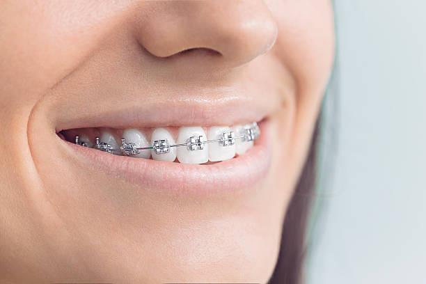 Best Dental Fillings (Composite and Amalgam)  in Georgetown, IL